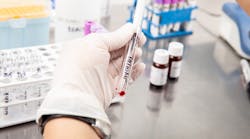 FIGURE 1. Preparing a blood sample prior to testing.