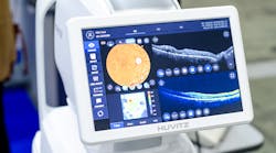 FIGURE 1. OCT has allowed clinicians to better diagnose ophthalmic diseases such as age-related macular degeneration (AMD), which causes blurred vision.