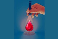 The new minimally invasive screening approach needs just a single drop of blood to detect health conditions.
