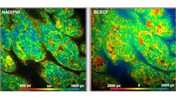 Metabolic FLIM with Simultaneous pH Imaging