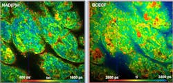 Metabolic FLIM with Simultaneous pH Imaging